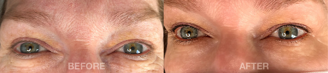 PhiContour Lash Enhancement